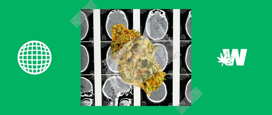 Cannabis Help with Sclerosis