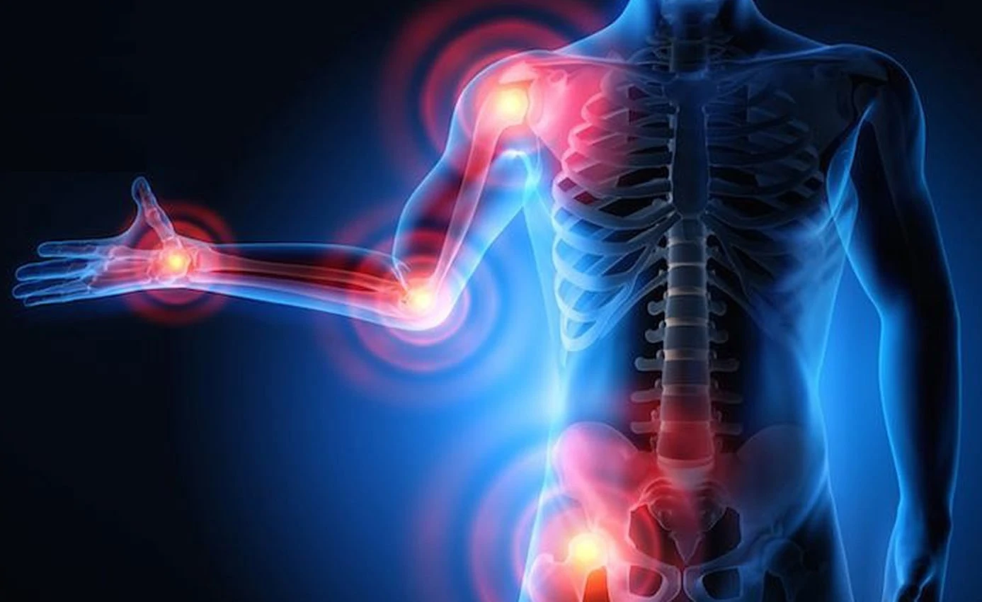 Anti-Inflammatory Properties of THCA